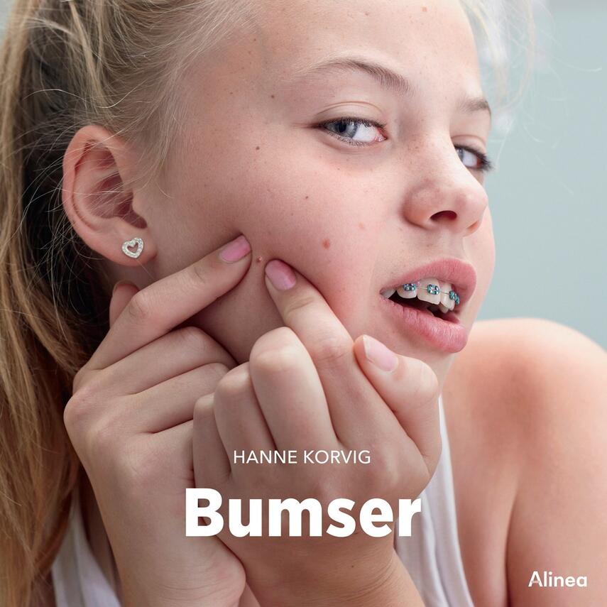 Hanne Korvig: Bumser